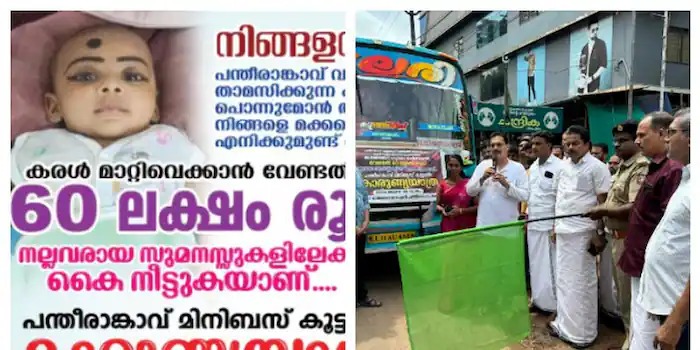 ആറുമാസം പ്രായമുള്ള കുഞ്ഞിന്‍റെ കരൾമാറ്റ ശസ‍ത്രക്രിയ; കൈത്താങ്ങായി സ്വകാര്യ ബസുടമകൾ