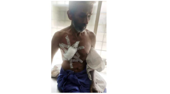 കാ​ട്ടു​പോ​ത്തി​ന്‍റെ ആ​ക്ര​മ​ണ​ത്തി​ൽ തൊ​ഴി​ലാ​ളി​ക്ക് പ​രി​ക്കേ​റ്റു