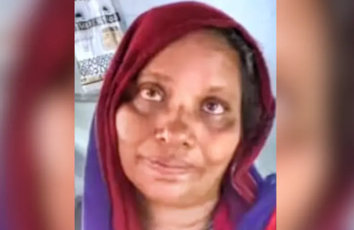 റോഡ് മുറിച്ചു കടക്കുന്നതിന്നിടെ ഓട്ടോ ഇടിച്ച് ഒരു മരണം