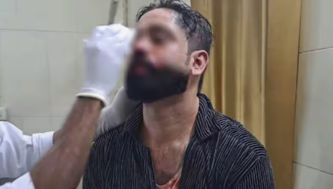 ഭക്ഷണം തയ്യാറാകാന്‍ വൈകുമെന്ന് പറഞ്ഞു ; യുവാക്കൾ ഹോട്ടല്‍ ഉടമയെ മര്‍ദ്ദിച്ചു
