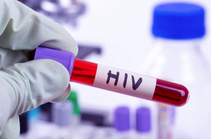 HIV-680x450 (1)