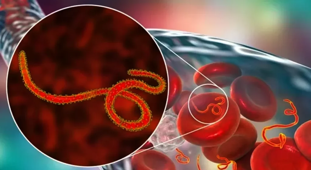 ebola