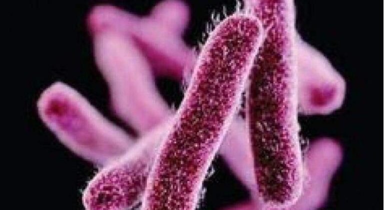 samakalikamalayalam_2024-07_2af5cd24-eeb0-4f70-8a6b-3a2a642de1d9_shigella_infection-1