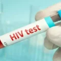 hiv