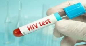 hiv