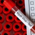nipah-virus-1-1024x614
