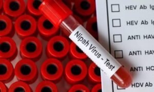 nipah-virus-1-1024x614